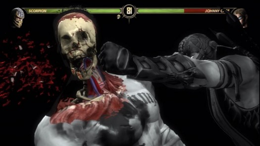 mortal kombat xray